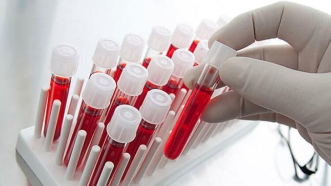 Koronavirus Asisi Koronavirus Asisi